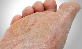 Ścieżki transmisji grzybów stóp