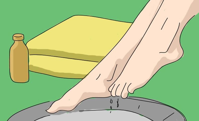 Kąpiel z octu jabłkowego na grzybicę stóp